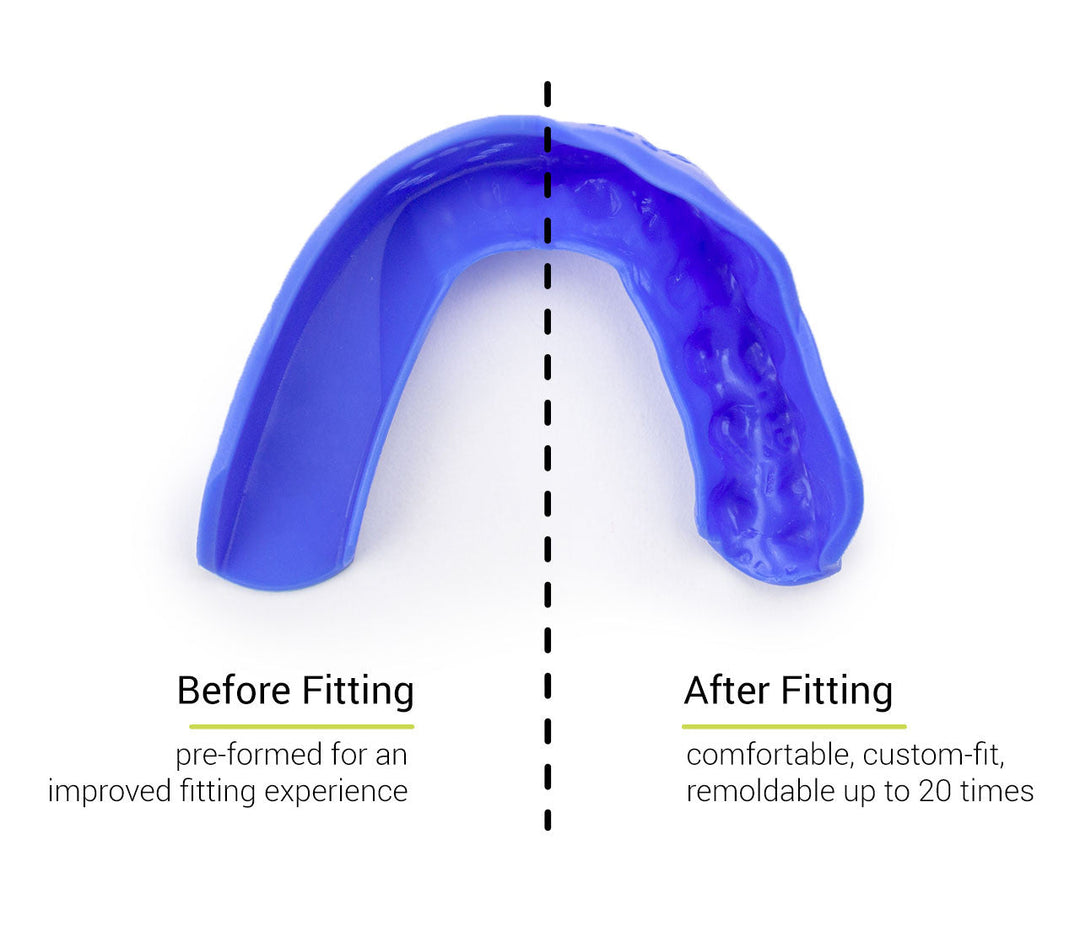 Sisu 3D Custom Fit Youth Mouth Guard